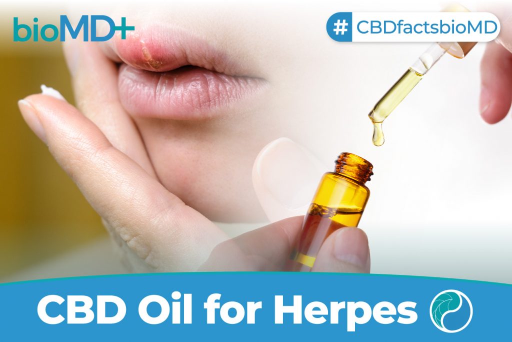 cbd oil for herpes help tincture cream