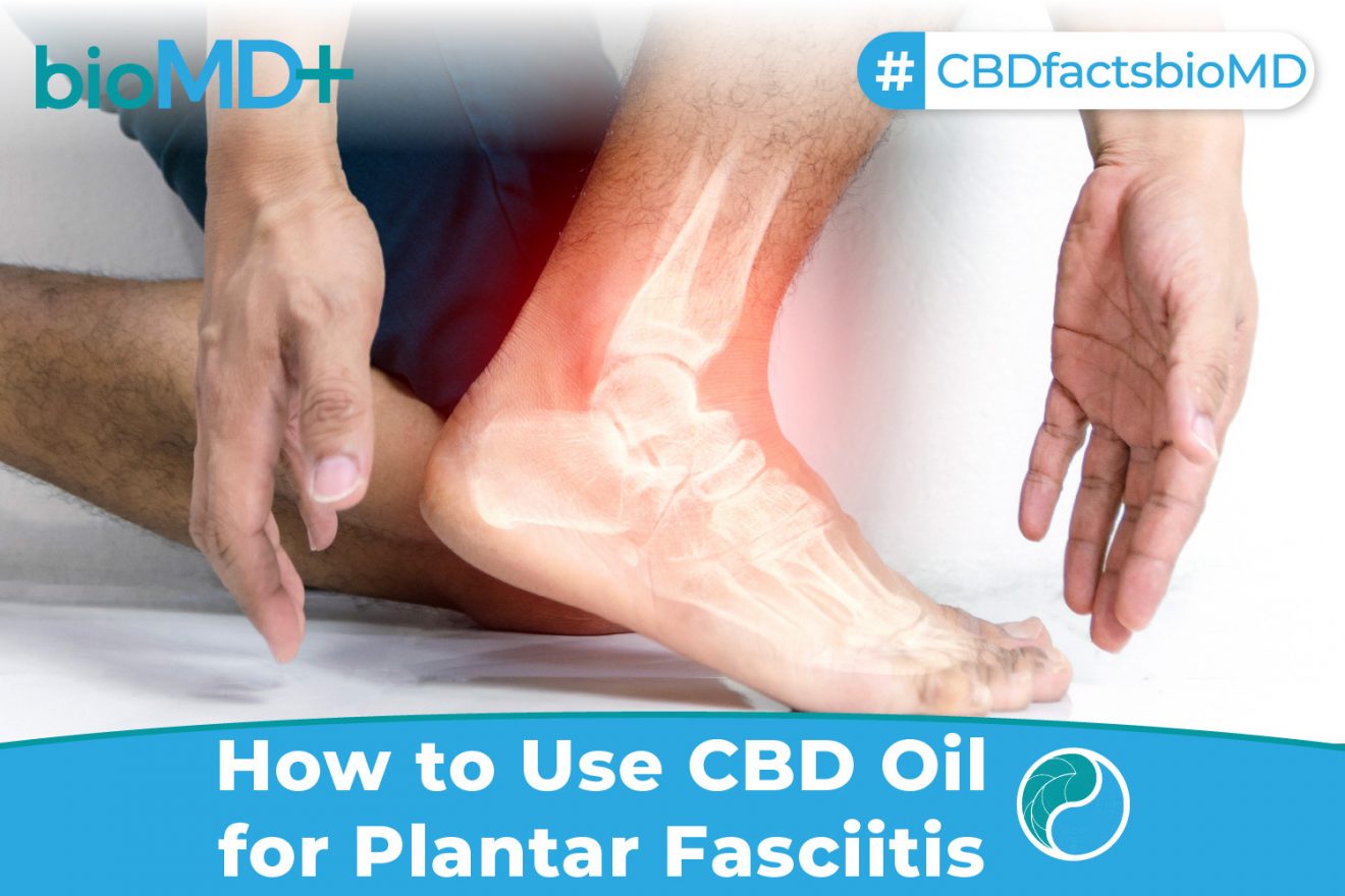 How To Use CBD Oil For Plantar Fasciitis? Everything You