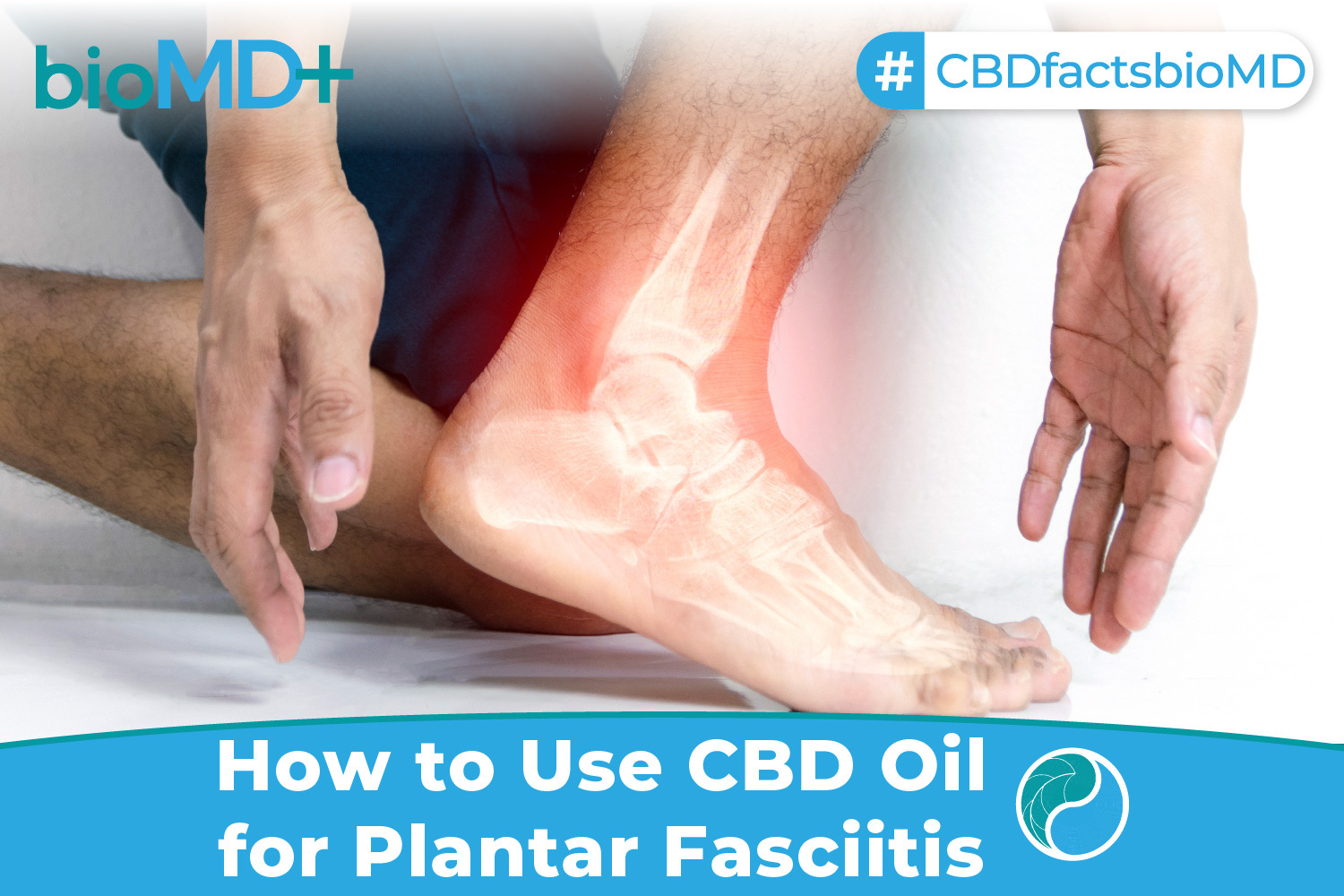 bio article How to Use CBD Oil for Plantar Fasciitis